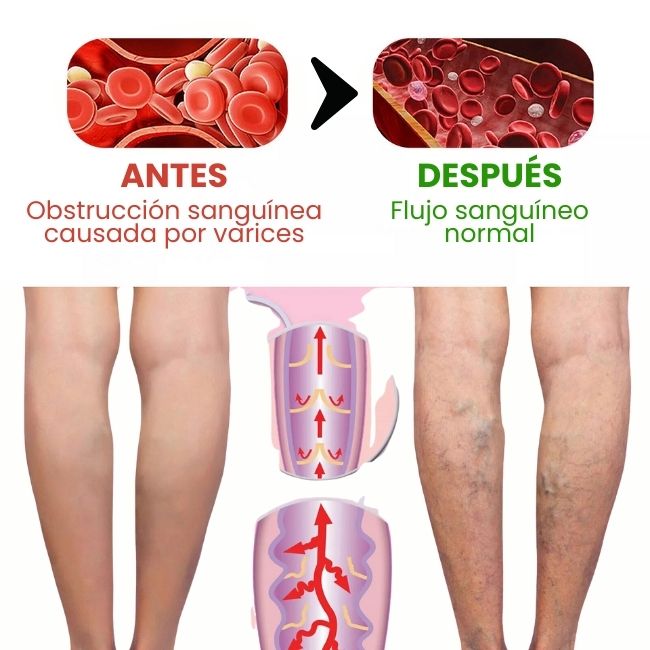 SUPER COMBO, crema dolores y articulaciones + Crema Varicose Veins, 3 x 1