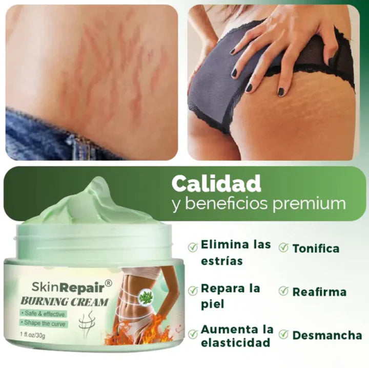 Crema tratamiento Antiestrias Skinrepair